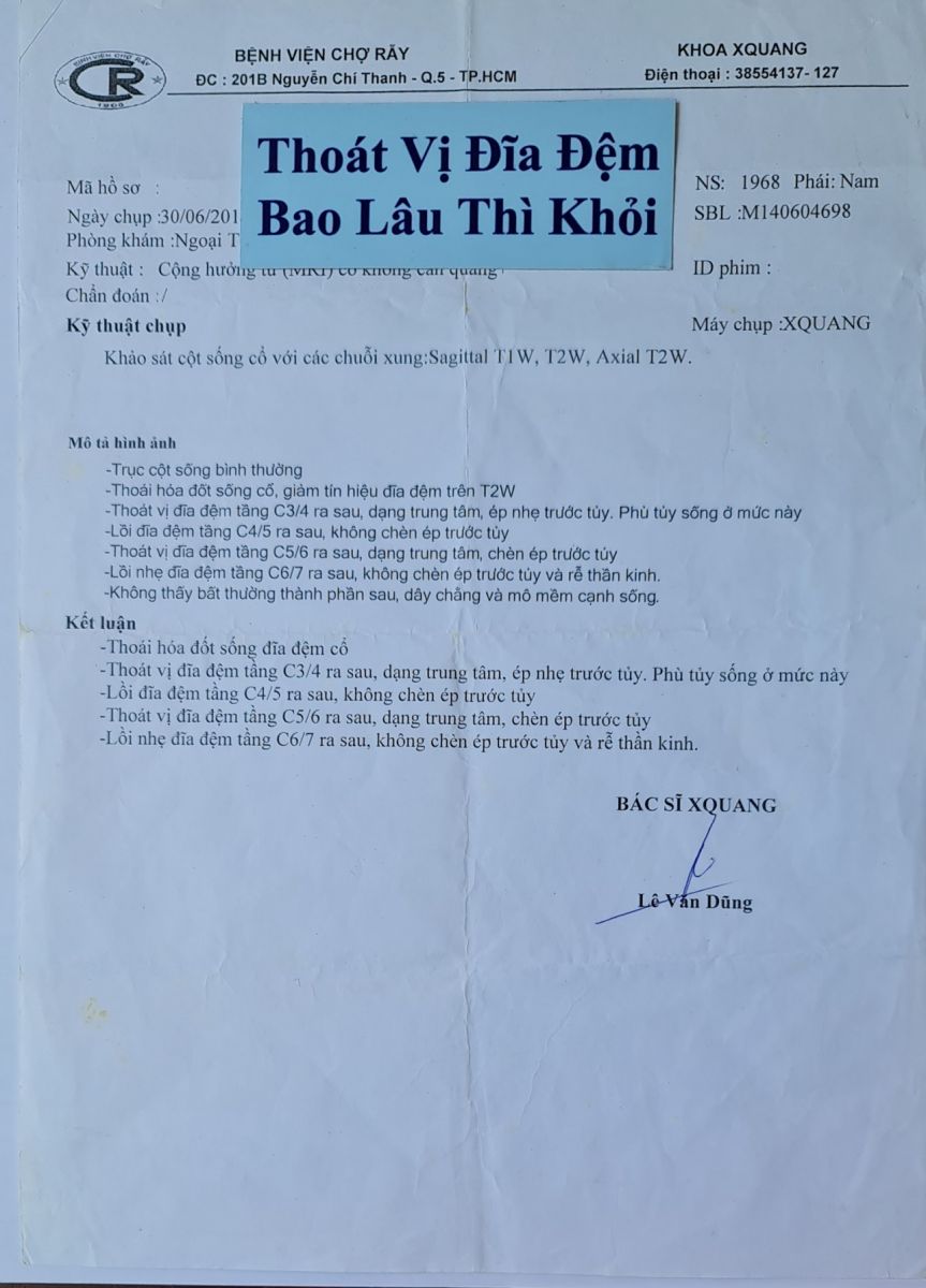 Thoát vị đĩa đệm bao lâu thì khỏi